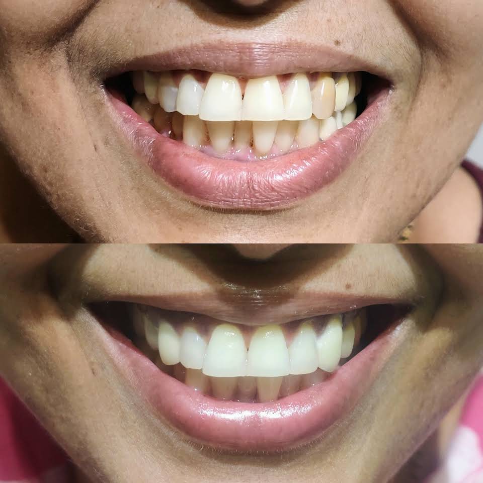Case Images