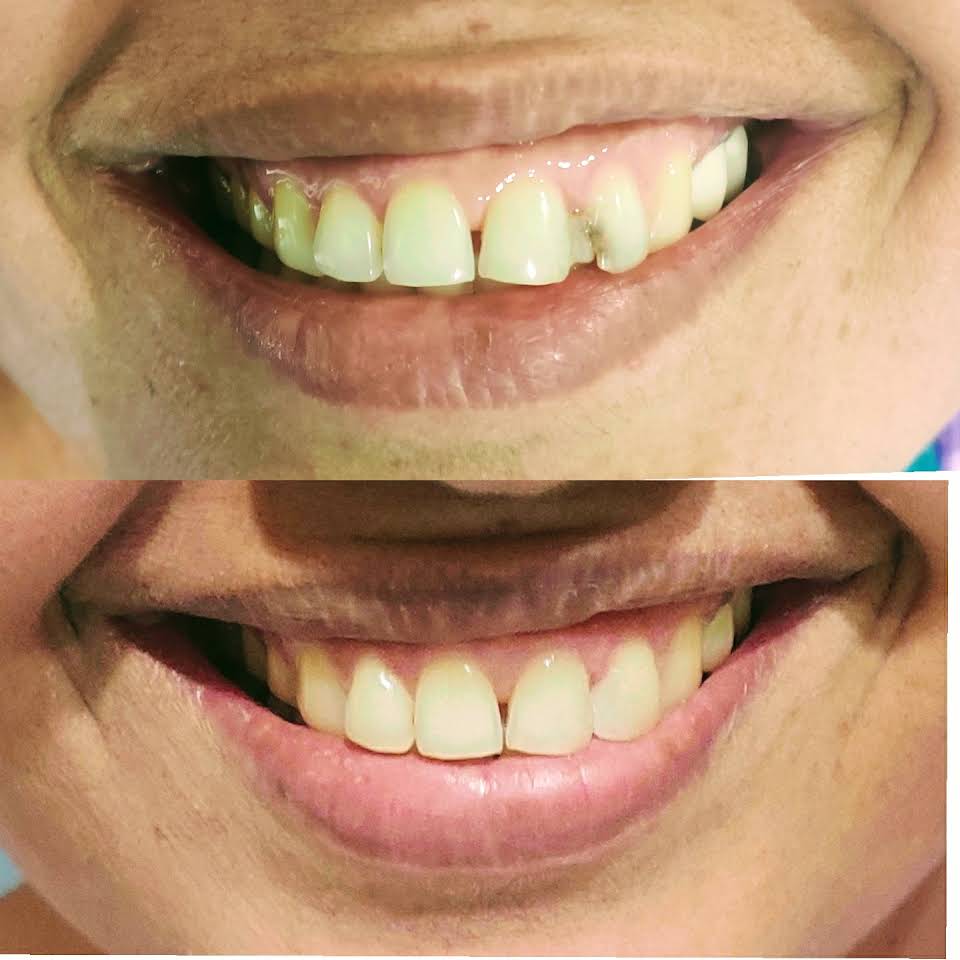 Case Images