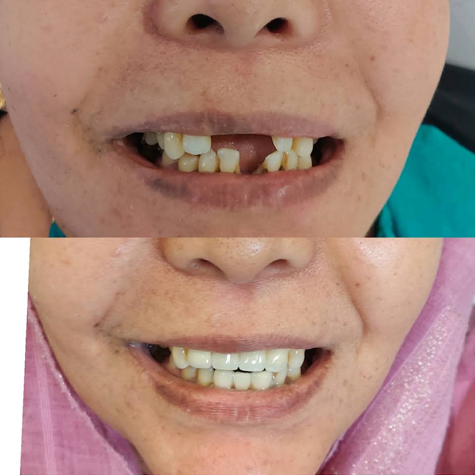 Case Images